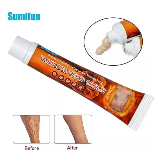 Crema Para Traramiento Varices Flevitis Alivio Dolor Fragancia Neutra