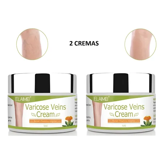 Crema Varices Irlandesa Para Inflamacion Y Circulacion