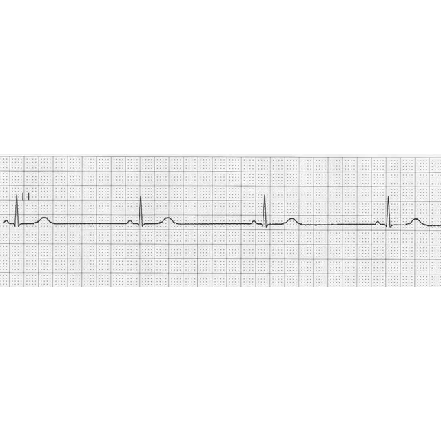 Papel P/ Electrocardiógrafo 50mmx30mts Cardio Charts X 10 U