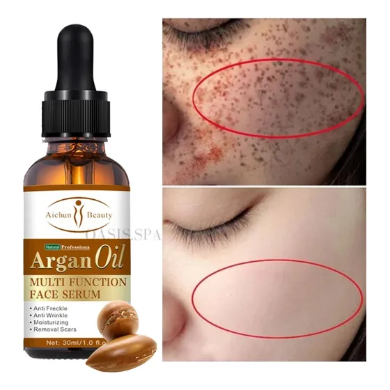 Serum Facial Aceite De Argán Anti Pecas Manchas Oscuras