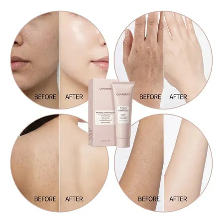 Quarxery Br Esfoliante Corporal Suave Em Gel Com Flor De Damasco. Remove Células Mortas De Braços E Pernas, Deixando A Pele Lisa E Renovada. Sensível Dia/noite