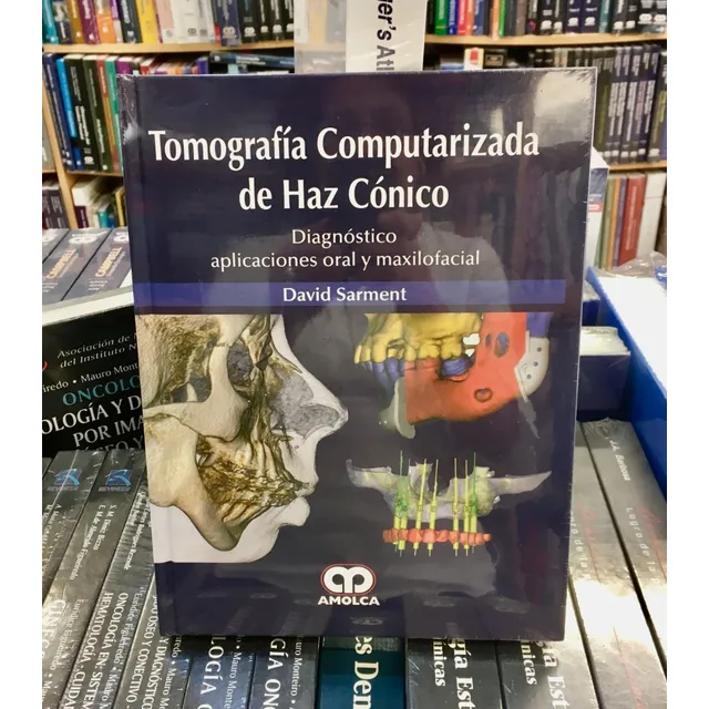 Tomografía Computarizada De Haz Cónico Diag Aplic Oral Y Max