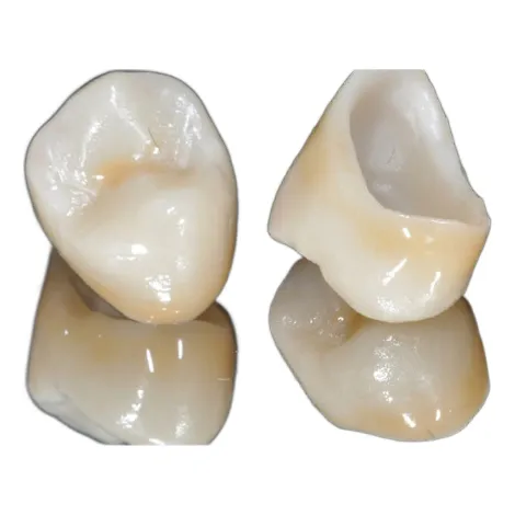 Corona Dental De Porcelana Tecnología Cad Cam