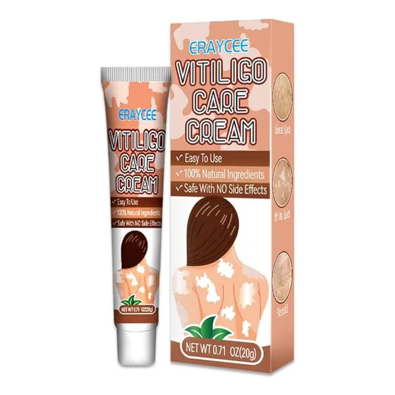 Crema Para El Vitíligo: Tratamiento Natural Y Eficaz