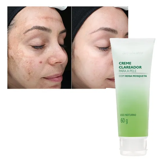 Tira Olheiras Creme Rosa Mosqueta Clareia E Hidrata A Pele