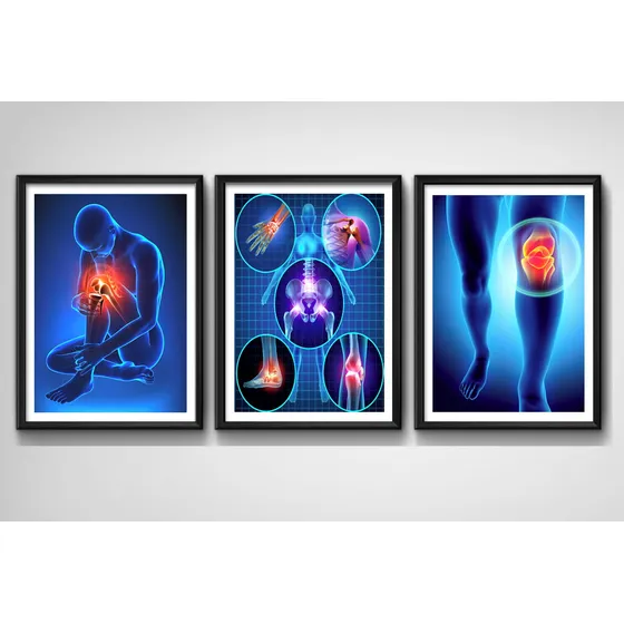 Set 3 Cuadros Ortopedia Médico Rayos X Cuerpo Humano Clinica