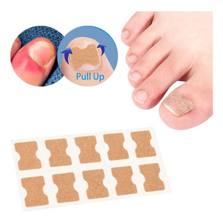 10 Adesivos Correção Unhas Encravadas Fitas Desencravador 10 Adesivos Correção Unhas Encravadas Fitas Desencravador