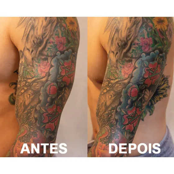 Pomada Pós Tatuagem Choice Bro Embaixador 50g