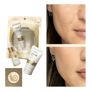 Kit Sérum Hidratante Facial Anti Rugas Snail Laikou Kit Sérum Hidratante Facial Anti Rugas Snail Laikou