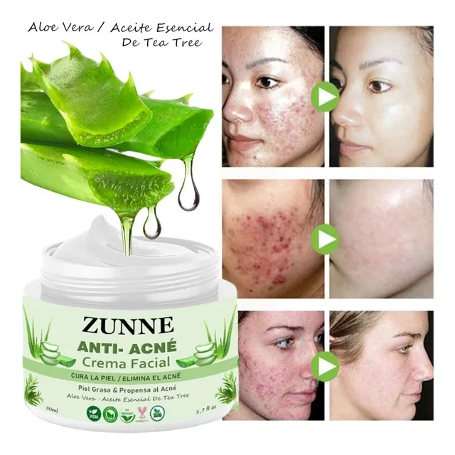 Crema Anti-acné/ Aloe Vera / Tea Tree / 100% Pura & Orgánica