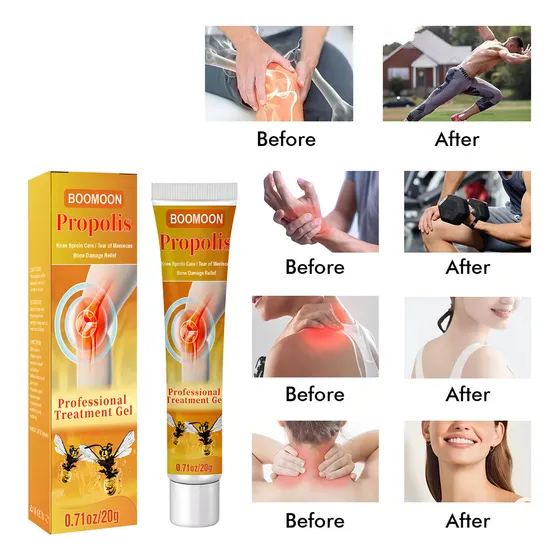 Crema De Veneno De Abeja Para El Dolor Articular