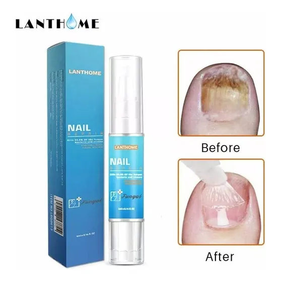 Suero Crema Reparacion Uñas Ataca Hongos Onicomicosis Import