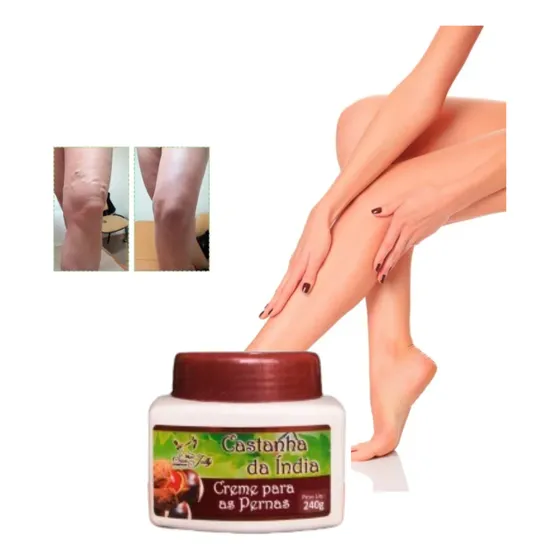 Creme Concentrado Tira Varizes Vasinhos Veias Cansaço Vasos 