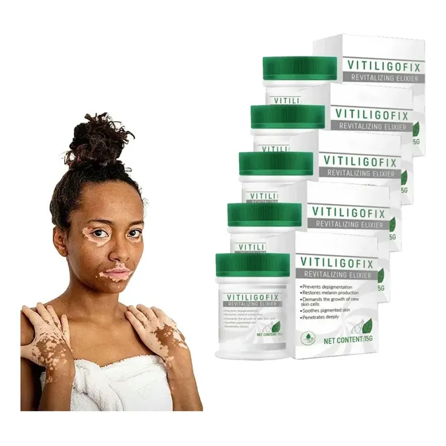 Ungüento 5blanca Para Vitíligo, Crema Para Micosis, Leucopla