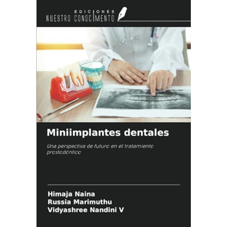Miniimplantes Dentales: Una Perspectiva De Futuro En El Trat Miniimplantes Dentales: Una Perspectiva De Futuro En El Trat