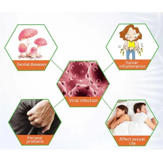 Tira Verruga Genital Hpv Seca Verruga Embalagem Discreta20ml