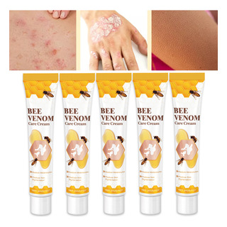 Crema Para El Cuidado Y Reparación De Manchas Blancas Para E Crema Para El Cuidado Y Reparación De Manchas Blancas Para E