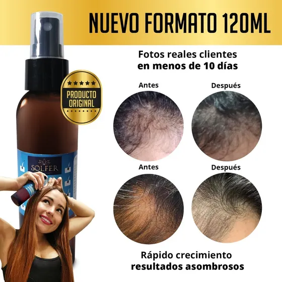 Spray Liquido De Crecimiento Capilar Cabello Nuevo Original