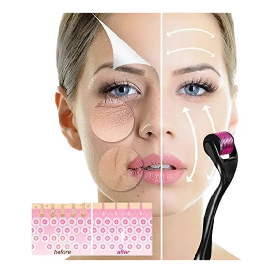 Derma Roller 540 | Arrugas Manchas Barba Alopecia 0.75 Mm