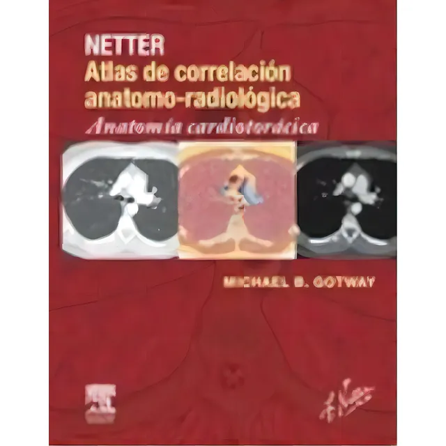 Netter. Atlas De Correlaciãâ³n Anatomo-radiolãâ³gica: Anatomãâa Cardiotorãâ¡cica, De Gotway, Michael B.. Editorial Elsevier España, S.l.u., Tapa Blanda En Español