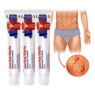 Xinnuo Wart Remover Genital Puglation 20g*3pcs Xinnuo Wart Remover Genital Puglation 20g*3pcs