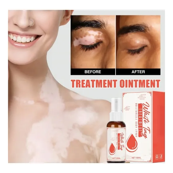 White Tag Spray Tratamiento Facial Corporal Vitiligo 50 Ml Neutra