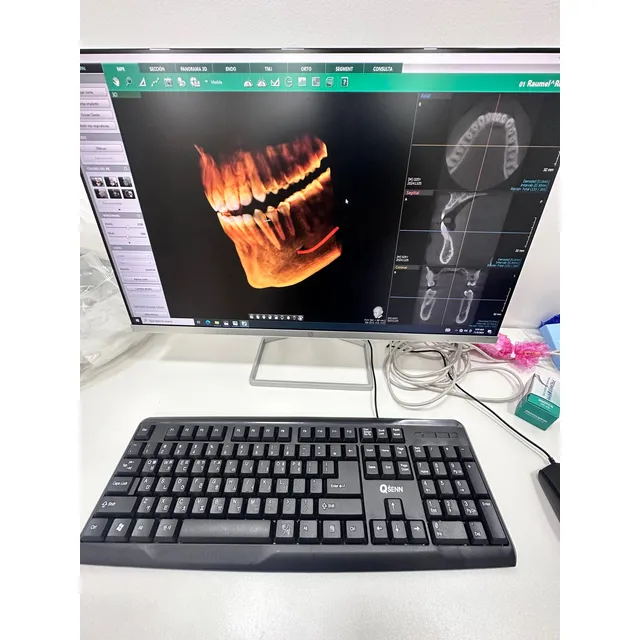 Rayos X Panoramico Cefálico 3d Odontología