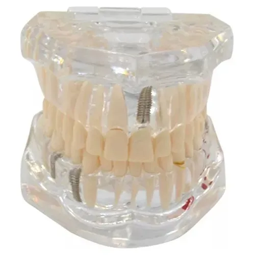 Dente Peca Acrilico Consultorio Modelo Estudo Odontologia