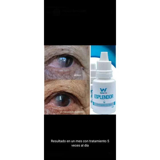 Esplendor Gotas De Ojo Homeopáticas