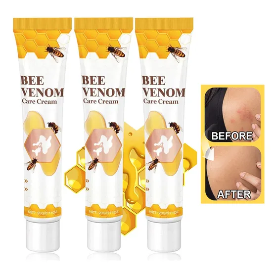 Crema De Tratamiento Para El Vitíligo Con Veneno De Abeja, 6