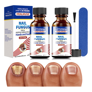 30ml*2 LĂquido Para Hongos En Las Uñas-tratamiento Para Uñas 30ml*2 LĂquido Para Hongos En Las Uñas-tratamiento Para Uñas