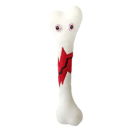 Peluche De Hueso Roto Giant Microbes, 20 Cm De Alto