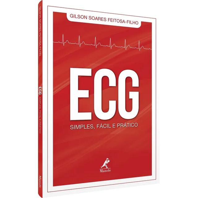 ECG sencillo, fácil y práctico realizado por Filho, Gilson Soares Feitosa. Editorial Editora Manole LTDA, tapa blanda en portugués, 2019