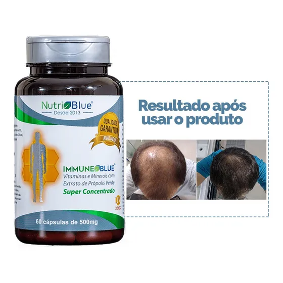Remédio Anti Queda Capilar E Cresce Cabelo Biotina 60 Capsul