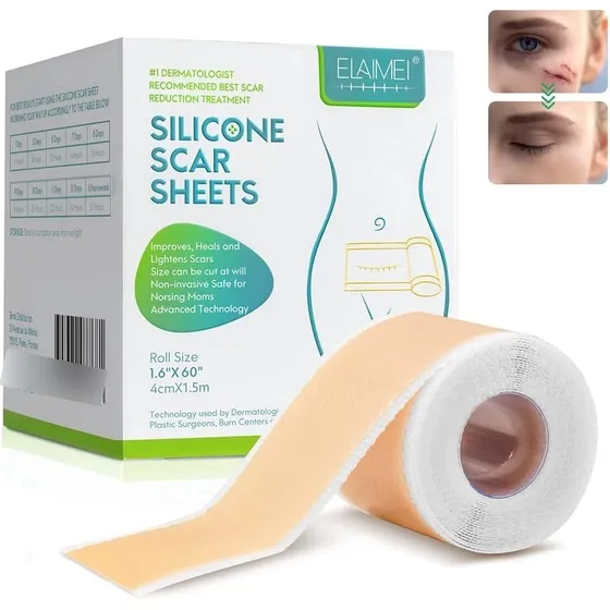 Silicona Scar Sheets Parche De Silicona Para Cicatrices 1.5m