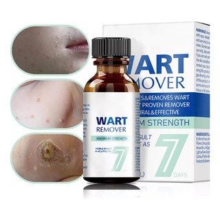 Tratamiento Y Eliminación De Verrugas Y Vph Tratamiento Y Eliminación De Verrugas Y Vph