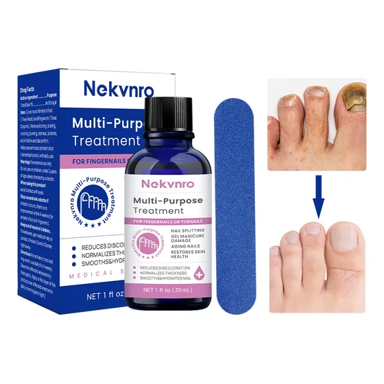 30ml Líquido Antibacteriano De Uñas Grises P/ Uñas Enfermas
