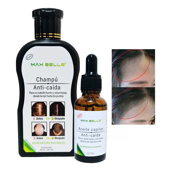 Kit Shampoo +serum Anticaida Crecimiento Estimulante Cabello