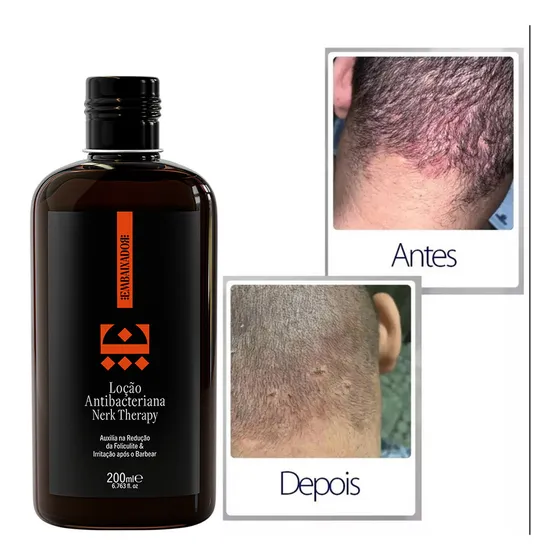 Loção De Combate A Foliculite Nerk Therapy Embaixador 200ml
