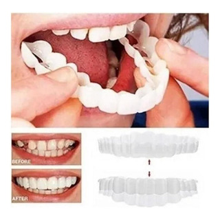 Dentes Falsos Com Sorriso De Silicone Na Parte Superior/inferior Banhados A W Dentes Falsos Com Sorriso De Silicone Na Parte Superior/inferior Banhados A W