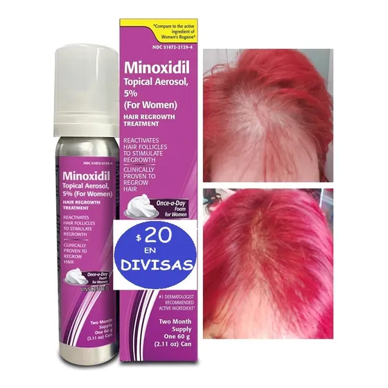 Minoxidil Rogaine 5% Damas Mujer  2 Meses Crecer Cabello