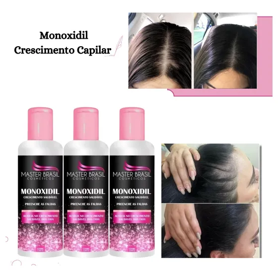 Kit 3 Monoxidil Crescimento Capilar 120ml Sérum 3x+poderoso