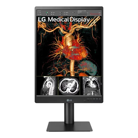 Monitor LG De Diagnostico 21.3` Ips 3mp Multi-resolucio