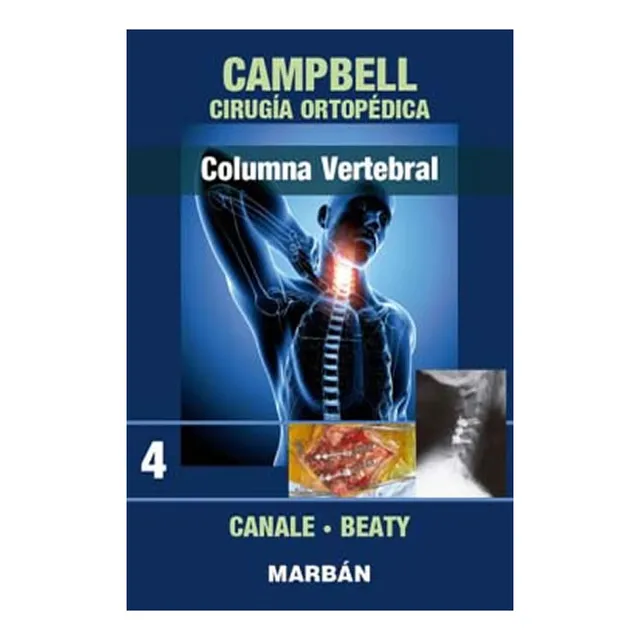Campbell Cirugia Ortopedica T 4 Columna Vertebral