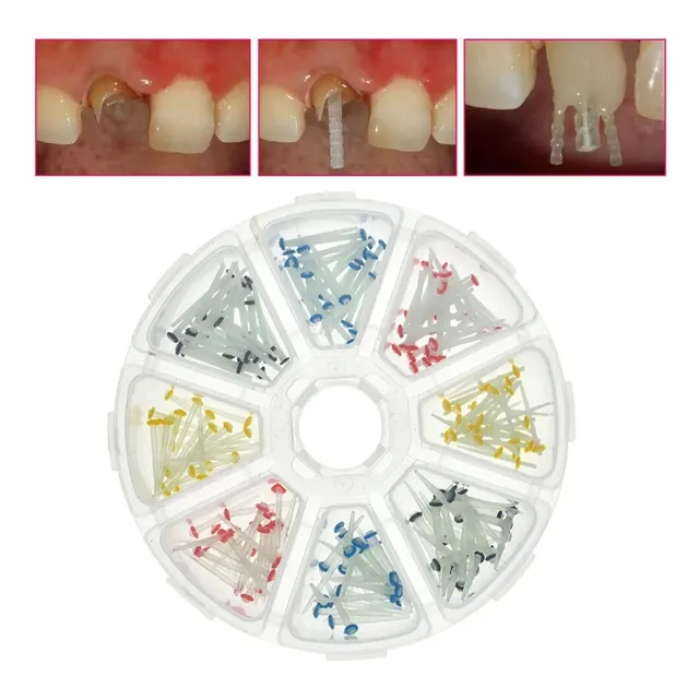 Set 200 Postes Pernos Fibra De Vidrio Dental Odontología 