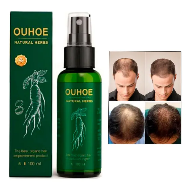 Spray Crecimiento De Cabello Comprobado , Nutre Y Fortalece