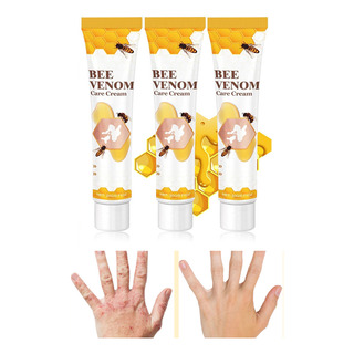Crema De Tratamiento Para El Vitíligo Bee Venom 6 Unidades E Crema De Tratamiento Para El Vitíligo Bee Venom 6 Unidades E