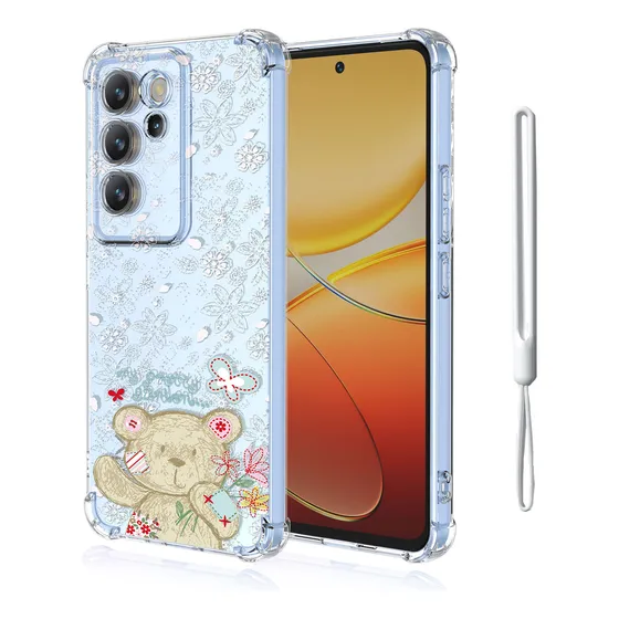 Funda Case Tpu  Para Vivo V30 Lite + Cordón