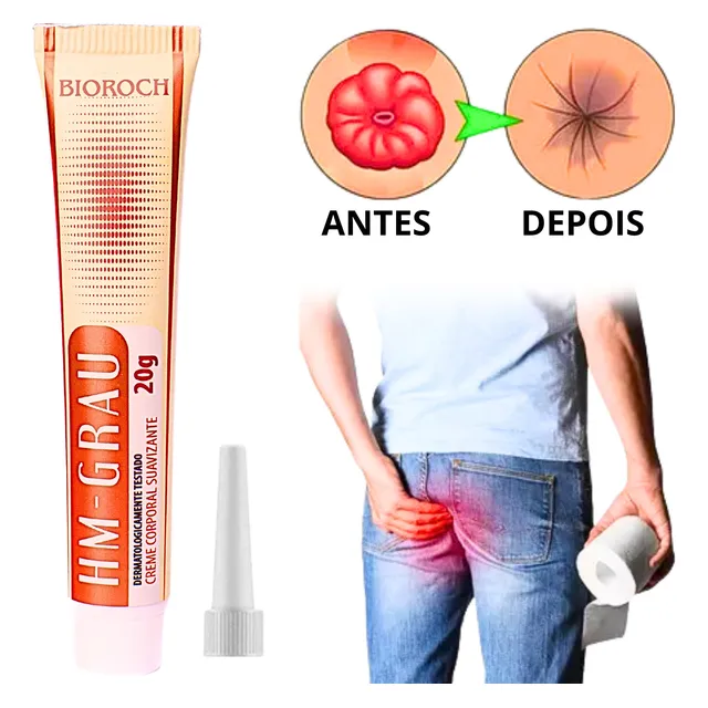 Pomada Para Hemorroidas Hm-grau Melhor Que Aliviozon Ozônio