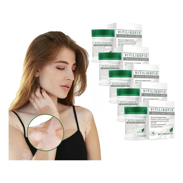 Ungüento 5blanca Para Vitíligo, Crema Para Micosis, Leucopla